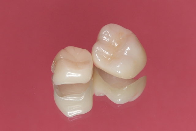 【広島市南区】 ピッタリな詰め物を選ぶポイントは？種類ごとの特徴解説